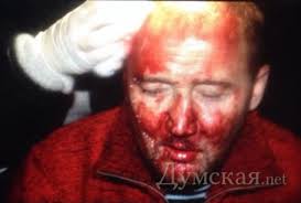 Журналистов в Киеве массово избивала милиция, а добивали провокаторы