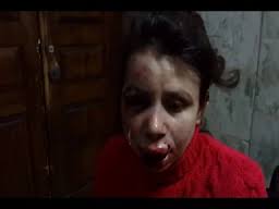 На каналі Княжицького знайшли слід «Громадського ТБ» в побитті Чорновол