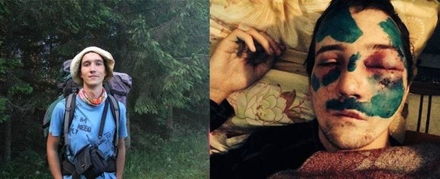 Суд оставил под стражей полуживого программиста, которого искалечила милиция