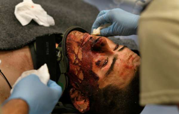 Киборг: За мой выбитый глаз они получили сполна