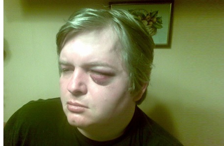 Богословская причастна к избиению лидера группы «Папы Карло», – Ирэна Карпа