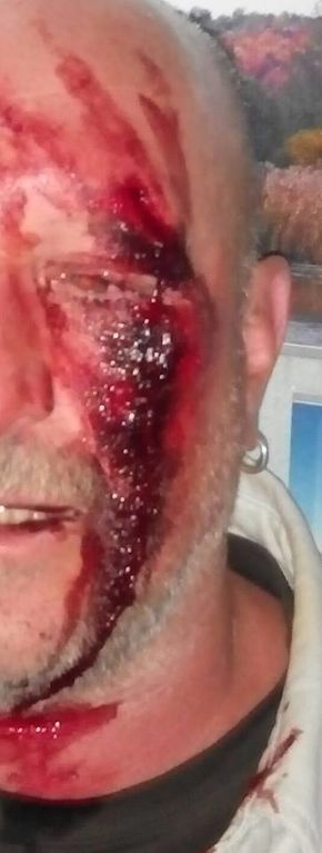 В центре Киева близ Верховной Рады жестоко избили мужчину