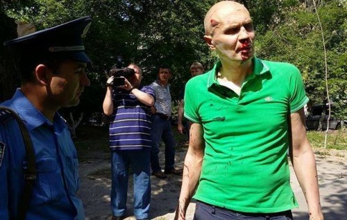 В Києві побили громадського активіста Віталія Черняховського