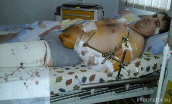 “Справа цинічних бандер” розвалюється