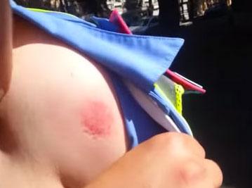 В Одессе автолюбитель безнаказанно покусал инспектора ГАИ (+видео)