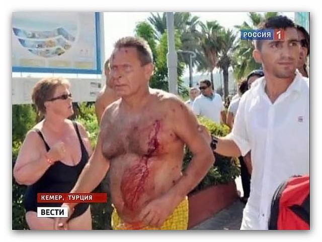 В драку между русскими и украинцами втянулся весь отель