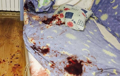 Головного захисника зелених зон Приірпіння Віктора Бархоленко жорстоко побили