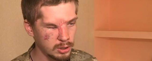 Родіон Тристан. Обличчя зі шрамом