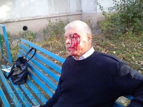 В Ильичевске напали на волонтера — помощника одного из кандидатов