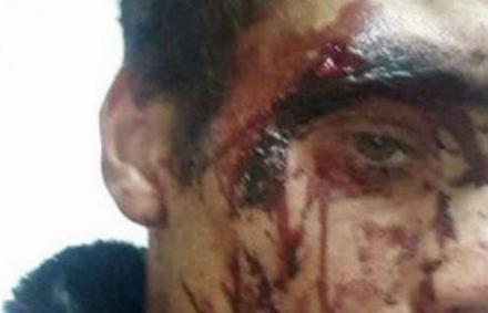 Голодные россияне устроили донбасским беженцам кровавую бойню из-за картошки (+фото)