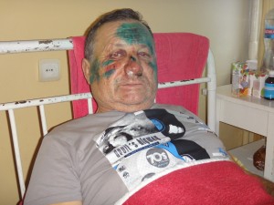 На Черкащині побили сільського голову, який протистоїть спорудженню пташників «Нашої ряби»