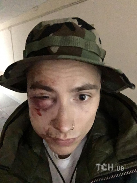 НЕИЗВЕСТНЫЕ ЖЕСТОКО ИЗБИЛИ УЧАСТНИКА QUEST PISTOLS SHOW