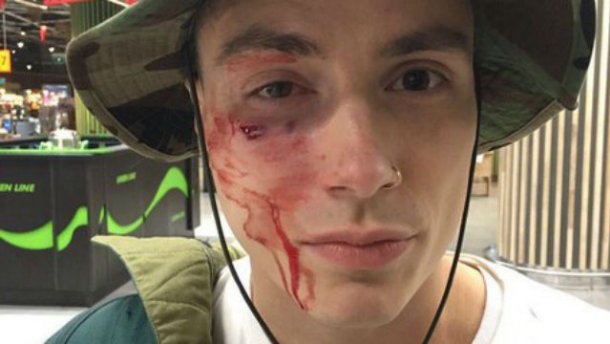 У Києві жорстоко побили відомого музиканта