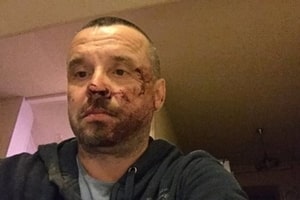 На Донетчине избили председателя областной "Батьківщини"