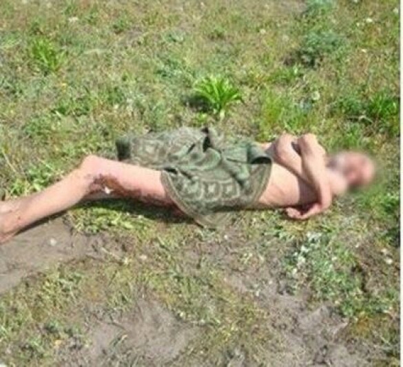 ЧП в Киеве: врачи оставили умирать бездомного под стенами морга