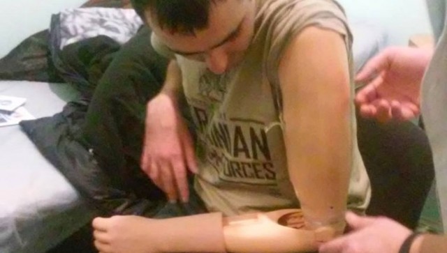 Протезирование бойцов АТО: «маржа» чиновников составляет колоссальные суммы