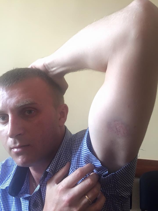 Начальник патрульної поліції Івано-Франківська побив ветерана АТО, пораненого під Іловайськом