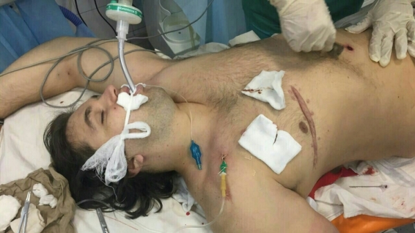 Убийца днепровских копов приполз в больницу, потеряв литр крови - врач