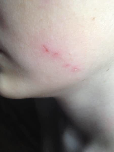 Скандал в днепровской школе: учительница на уроке расцарапала ребенку лицо