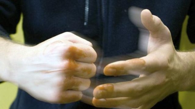 В Житомире до беспамятства избили гражданина Израиля