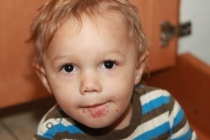 Україною поширюється жахливий вірус, що вражає дітей