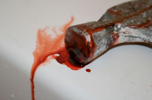 Женщина молотком избившая АТОшника: «В следующий раз завалю этого героя окончательно»