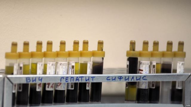 В Роспотребнадзоре заявили об увеличении количества ВИЧ-инфицированных в Севастополе