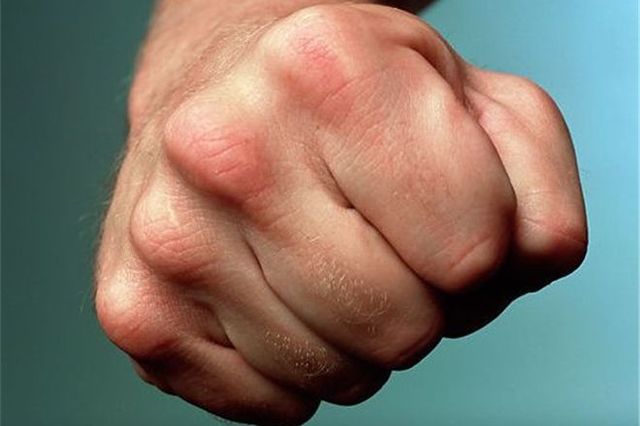 Полиция дала оценку происшествию, в котором пострадал участник АТО