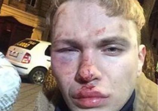 В Одессе избили и ограбили известного певца
