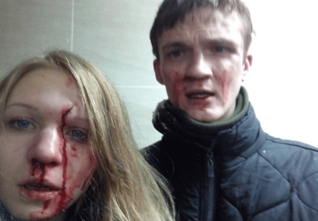 Виту Завируху и её парня избили в Киеве
