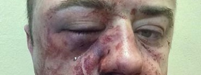 В Днепре известного юриста избили за его профессиональную деятельность