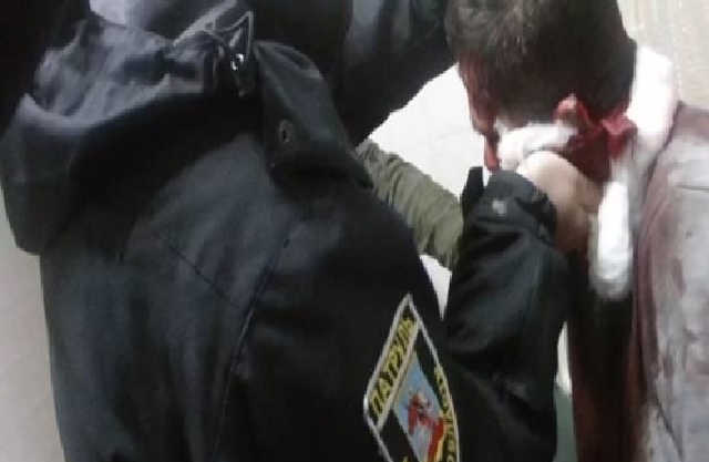 Под Киевом полицейские спасли жизнь тяжелораненому парню