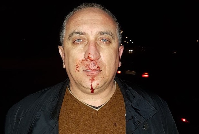 Депутати від БПП по-звірячому побили голову НРУ Ярослава Павліва