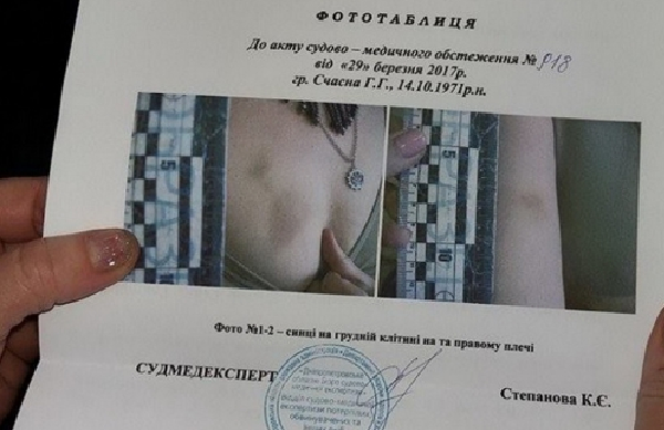 Избитой вдове ветерана АТО предлагали деньги за молчание. Новые подробности