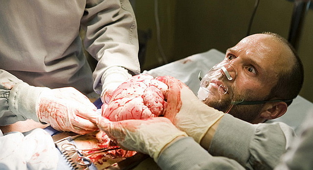 В Киеве поймали банду трансплантологов, покупавших почки украинцев за 15 долларов