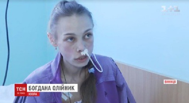 На Винничине 16-летняя школьница по неизвестным причинам похудела до 23 кг