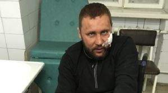 Зачинщиком драки в Тернополе является сам пострадавший