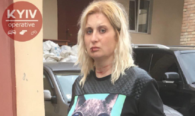 В Киеве женщину двое суток удерживали в сексуальном рабстве