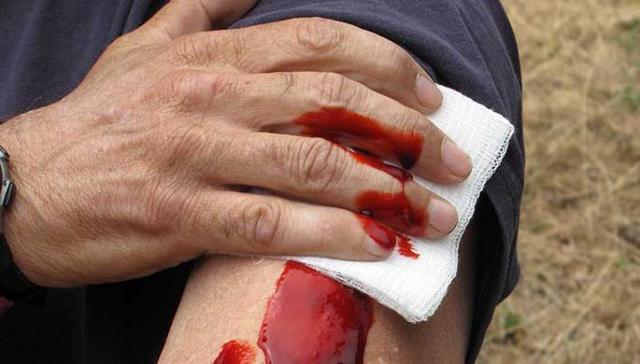 Стрельба в Кропивницком: у парня ранены ноги и рука