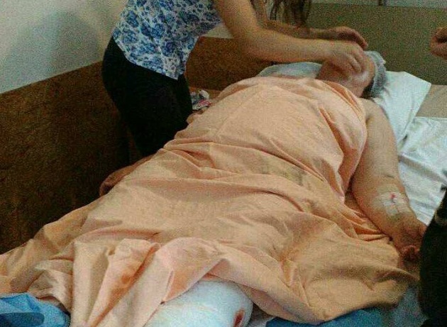 От мощного взрыва в столичной маршрутке женщине разорвало ногу