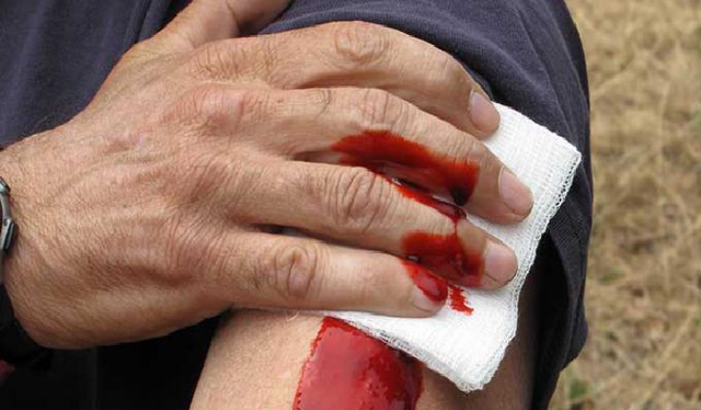 На учениях Кривом Роге силовики выстрелили в шею журналисту