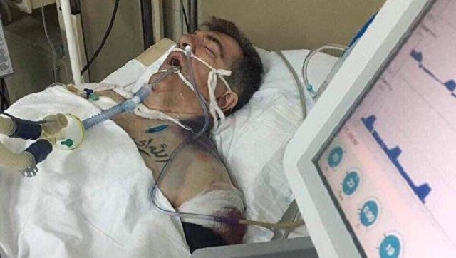 Покушение на Осмаева и Окуеву: подстреленный "киллер Динго" признан потерпевшим