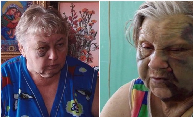 Драка пенсионерок в Житомире: стали известны детали кровавого побоища