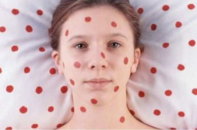 Украинцев косит инфекция: как защитить себя и близких