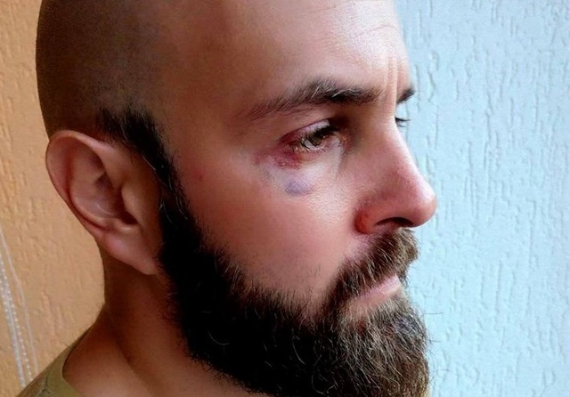 Произвол системы: в Житомире известного активиста избили и самого обвинили в покушении