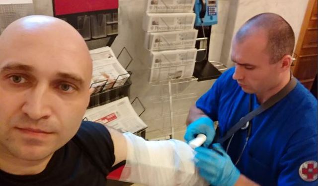 В Москве активисту сломали руку за то, что он припарковался на месте мэра