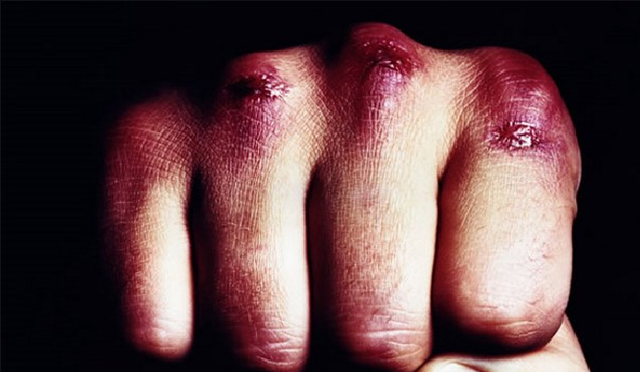 На Ревуцкого титушки, которые перекрывали дорогу, проломили голову охраннику заправки