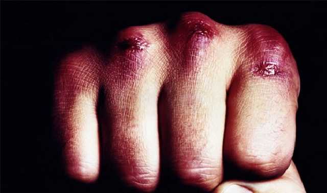 В Харькове избили депутата от «Самопомощи» (фото)