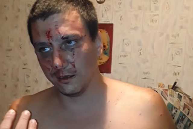 В Чернигове активисты вычислили сепаратиста, оскорбившего девушку-волонтера