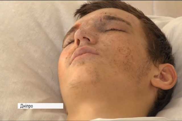 "Хотів щось зробити для Батьківщини, ціною життя": 18-річний боєць-сирота підірвався на міні й тепер дуже потребує допомоги